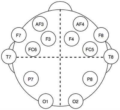 WISDoM: Characterizing Neurological Time Series With the Wishart Distribution